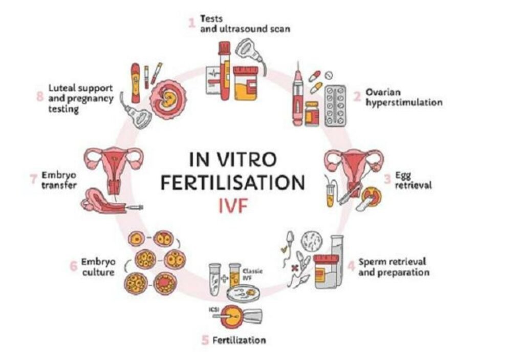ivf stages